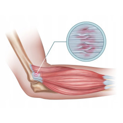 ACTIVLAB ORTOTENDON NA STAWY KOŚCI TENDINOPATIA ŚCIĘGNA 30 CAPS ACTIVLAB ORTOTENDON NA STAWY KOŚCI TENDINOPATIA ŚCIĘGNA 30 CAPS